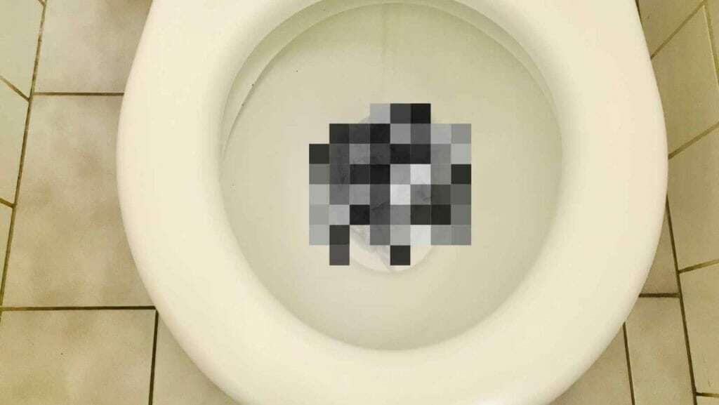 Photo of a clogged toilet with poop.